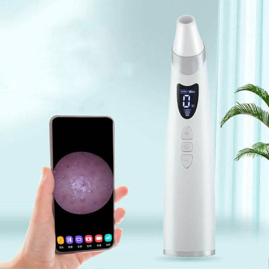 Electric Blackhead Remover - Visual Pore Cleaner Suction Tool - Vezir